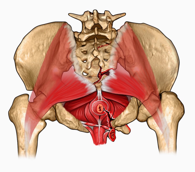 come curare le alterazioni del pavimento pelvico 2